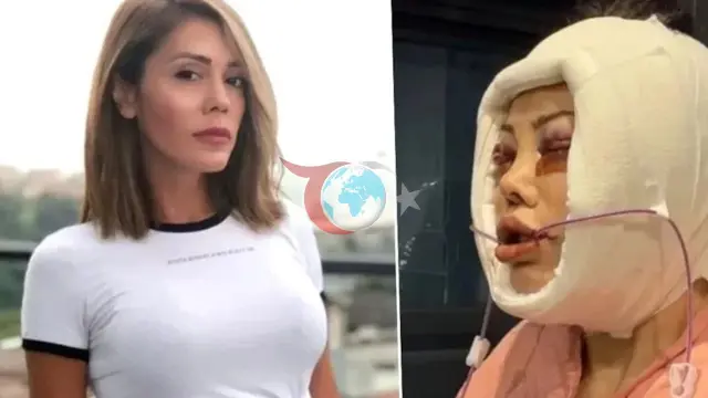 Didem Ceran'dan Üzücü Haber: Kanserle Mücadele Ediyor