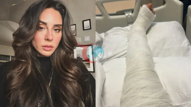 Yasemin Yürük Geçirdiği Kaza Sonrası Sağlık Durumunu Paylaştı