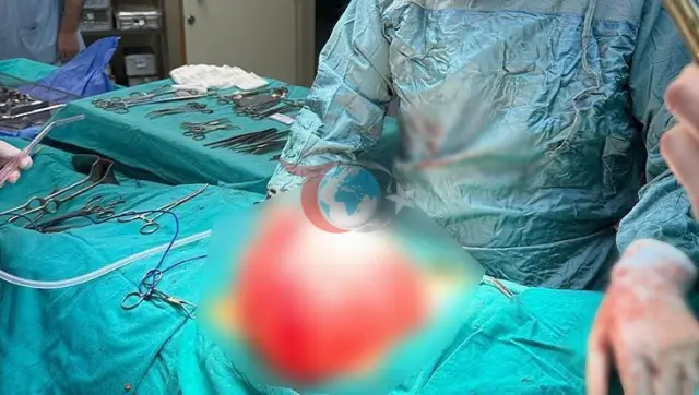 14 Yaşındaki Öğrencinin Karın Bölgesinden Çıkan Şaşırtıcı Kist