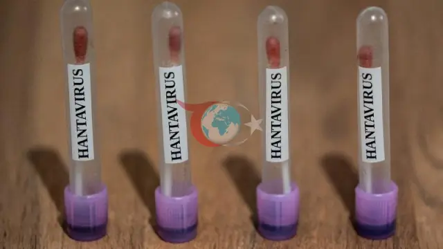CDC, ABD'de Hantavirüs Vakaları İçin '3. Seviye Acil Durum' İlan Etti