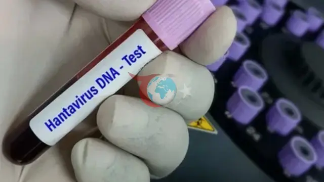 DSÖ: Hantavirüsün Küresel Tehdidi Düşük Seviyede