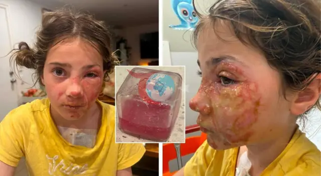 Sosyal Medyada Tehlikeli Akım: Çocuklar Yanık Riski Altında!
