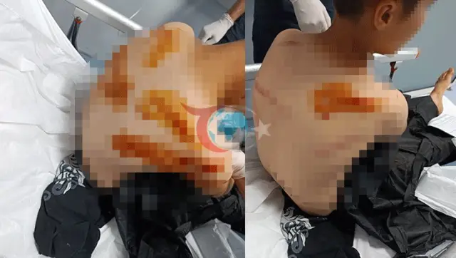 Шанлыурфада көрші 11 жасар балаға шабуыл жасады