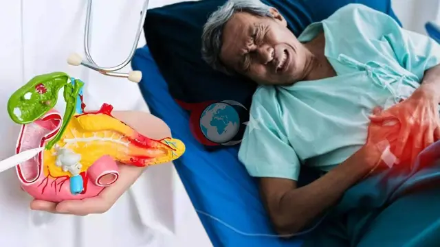 Sırta Vuran Şiddetli Karın Ağrısına Dikkat: Pankreatit Belirtisi Olabilir!