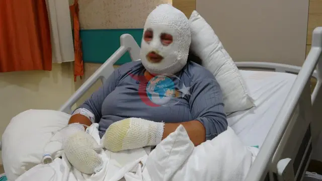 Ардахандағы ана террорға ұшырады: баласы үшін отқа сүңгіп кетті