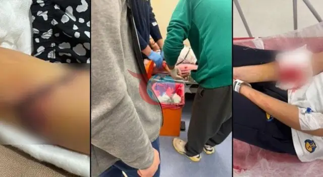 Okulda Dehşet Veren İhmal: Kapı Kolu Atardamarına Saplanan Asya Ölümden Döndü