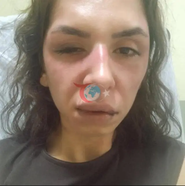 Aýalyny bozan adamsy Çekmeköýde tussag edildi: Düşünişmezlik barada çekişme Polisiýa bölüminde tamamlandy