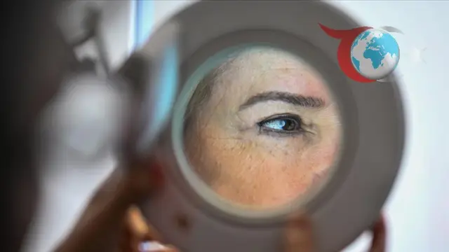 Ultraviyole Işınların Melanom Üzerindeki Etkisi Araştırıldı
