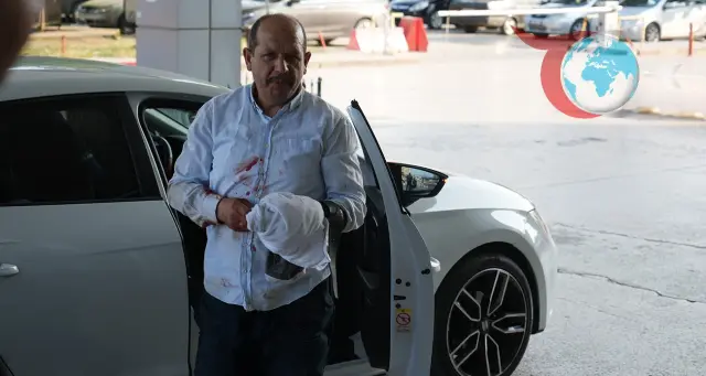 Kurban Bayramında Acemi Kasapların Zorluğu: Yaralanmalar Artıyor