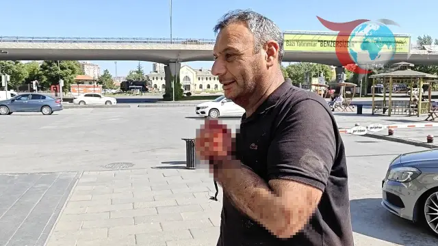Kayseri'de Kurban Bayramı'nda Acemi Kasaplar Hastanelik Oldu