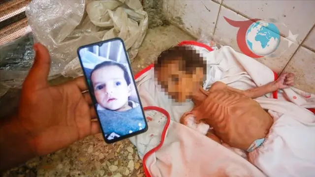 Gazze'de Bebek Mamalarının Tükenişi: Minik Curi'nin Ölümü