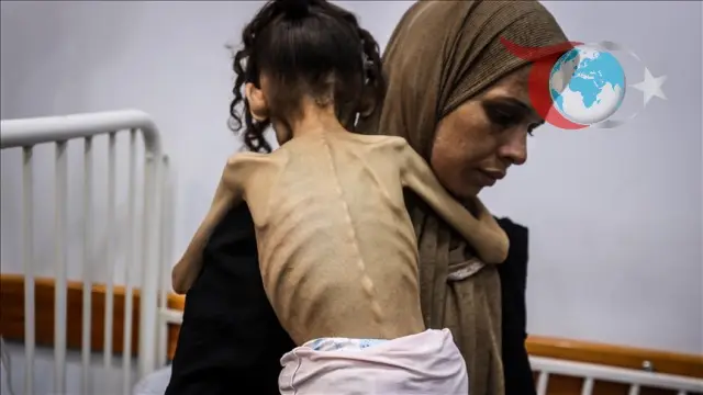 Gazze'de Dayanılmaz Açlık: Her Gün Can Kaybı Artıyor