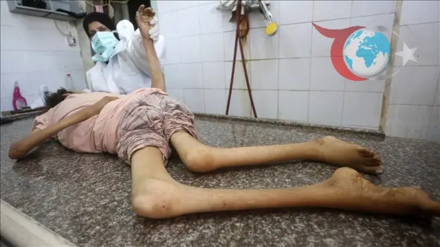 Gazze'de Artan Acılar: Açlık ve Saldırılar Hayatları Tehdit Ediyor
