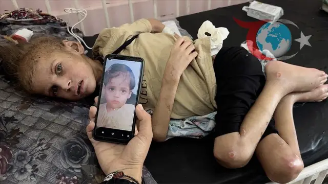 Gazze'de İnsanlık Krizi: Çocuklar Açlıkla Mücadele Ediyor