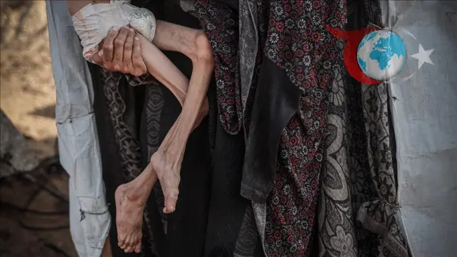 Gazze'deki Açlık Krizi: İnsani Felaketin Boyutları Büyüyor