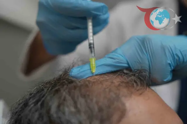 Saç Dökülmesi Sağlık Sorunlarının Habercisi Olabilir