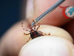 Kene Isırığı Sonrası Hayatını Kaybeden Çorumlu Çiftçi