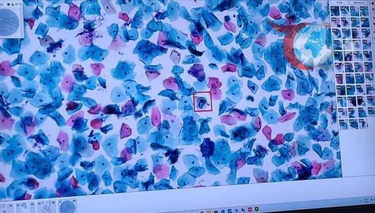 Yapay Zeka Sağlıkta Devrim Yaratıyor: Kanser Tanı ve Tedavisinde Yeni Dönem