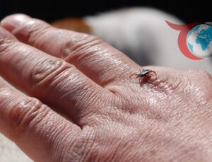 Erzincan’da Kırım Kongo Kanamalı Ateşi Tehlikesi: Uzmanlardan Hayati Uyarılar