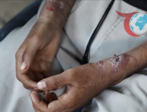 Gazze’deki Doktorların Mücadelesi: Bir Belgeselin Anlattıkları