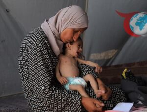 Gazze’deki Yetersiz Beslenme Krizi Alarm Veriyor