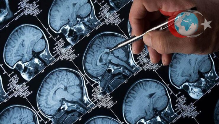 Alzheimer ile Mücadelede Lityum Çağı: Yeni Araştırmalar Umut Vaad Ediyor