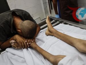 Gazze’de İnsani Kriz: Yetersiz Beslenme Bir Çocuğun Daha Canını Aldı