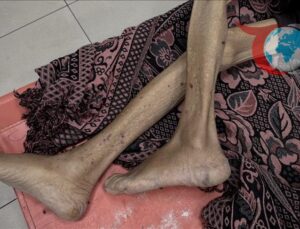 Gazze’de İnsanlık Krizi: Açlık ve Saldırılarda Bilanço Ağırlaşıyor