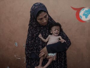 Gazze’deki Açlık Krizi: Minik Ammar’ın Trajik Mücadelesi