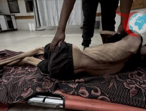 Gazze’deki Kriz: Açlık ve Yetersiz Beslenme Can Almaya Devam Ediyor