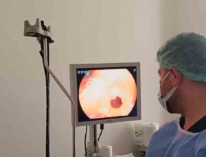 Çermik Devlet Hastanesi’nde Yenilik: Endoskopi ve Kolonoskopi Ünitesi Hizmete Başladı