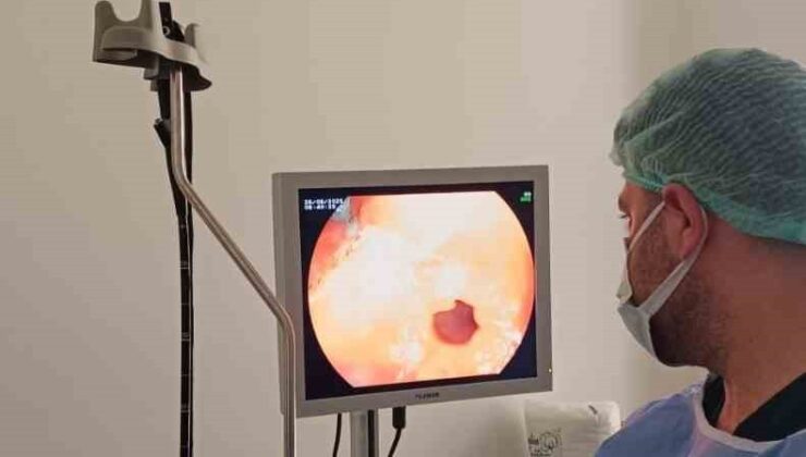 Çermik Devlet Hastanesi’nde Yenilik: Endoskopi ve Kolonoskopi Ünitesi Hizmete Başladı