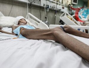 Gazze’de İnsani Felaket: Açlık ve Saldırılar Altında Hayat