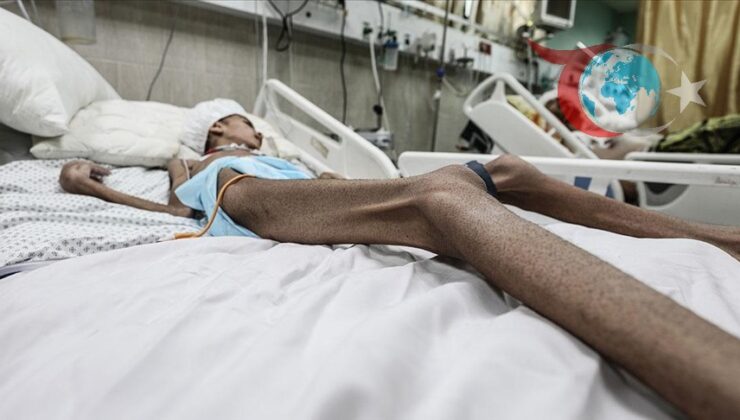 Gazze’de İnsani Felaket: Açlık ve Saldırılar Altında Hayat