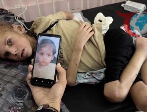 Gazze’de İnsanlık Krizi: Çocuklar Açlıkla Mücadele Ediyor