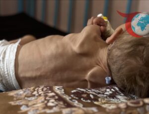 Gazze’de Kıtlık ve İsrail Saldırılarının Acı Bilançosu