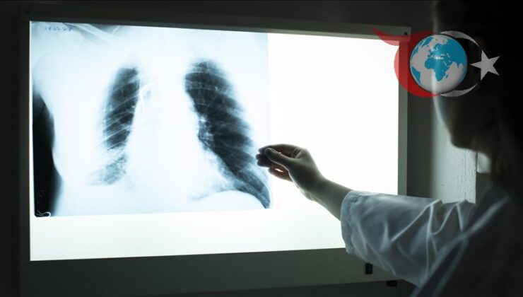Akciğer Kanserinde Erken Teşhis Yaşam Kurtarıyor