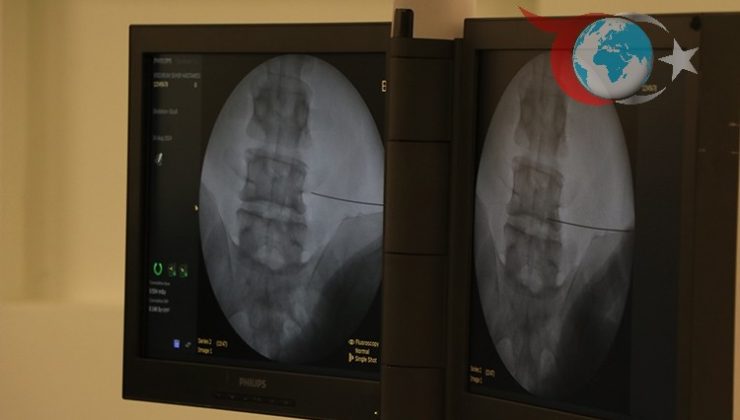 Fıtık Nedir ve Hangi Durumlarda Risk Taşır?