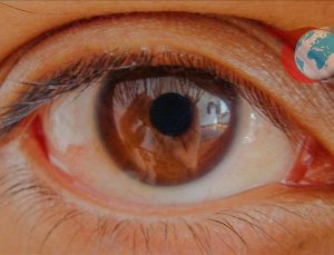 Göz Hastalıklarında Risk Faktörleri ve Glokomun Önemi