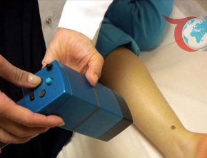 Solaryum Kullanımının Melanom Riskine Etkileri