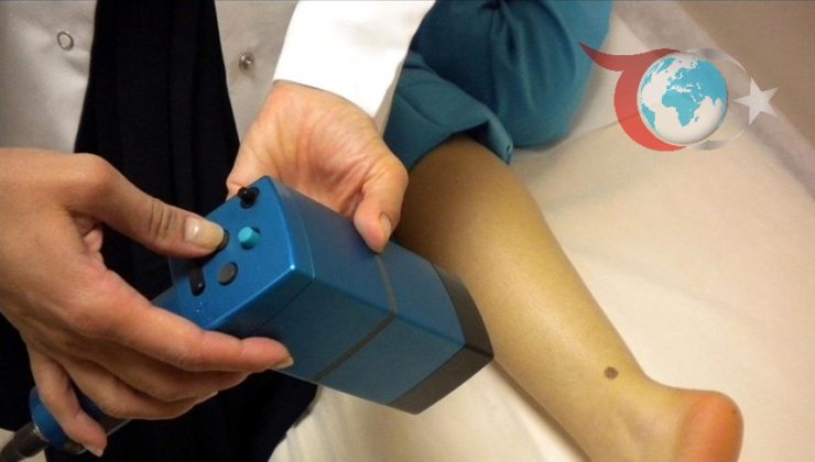 Solaryum Kullanımının Melanom Riskine Etkileri