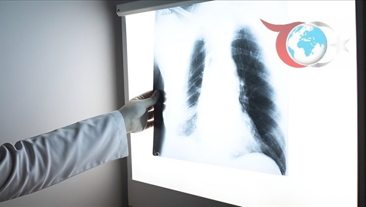 Viral Enfeksiyonların Solunum Üzerindeki Etkileri ve Korunma Yöntemleri